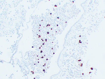 Adrenocorticotropin(ACTH) (ABT-ACTH) mouse mAb