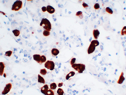 Adrenocorticotropin(ACTH) (ABT-ACTH) mouse mAb