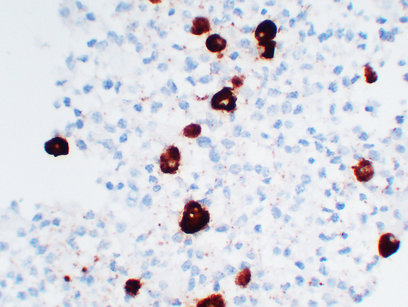 Adrenocorticotropin(ACTH) (ABT-ACTH) mouse mAb