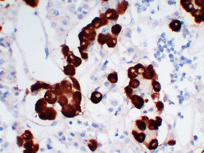 Adrenocorticotropin(ACTH) (ABT-ACTH) mouse mAb