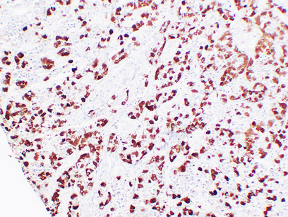 Adrenocorticotropin(ACTH) (ABT-ACTH) mouse mAb