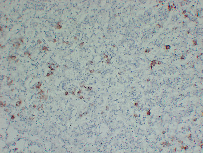 Thyroid-Stimulating Hormone(TSH) (ABT-TSH) mouse mAb