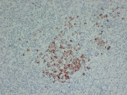 Thyroid-Stimulating Hormone(TSH) (ABT-TSH) mouse mAb