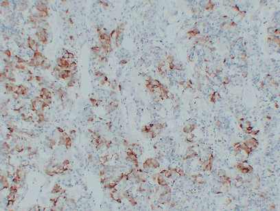 Thyroid-Stimulating Hormone(TSH) (ABT-TSH) mouse mAb