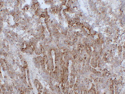 Follicle-Stimulating Hormone (FSH) (PT0555) mouse mAb