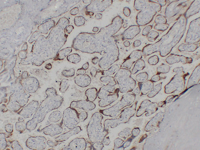 hCG β (ABT-HCGβ) mouse mAb