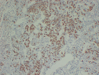 Growth Hormone(GH) (ABT-GH) mouse mAb