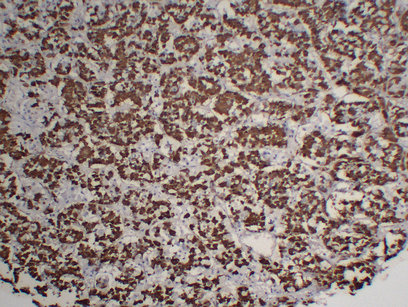 Growth Hormone(GH) (ABT-GH) mouse mAb