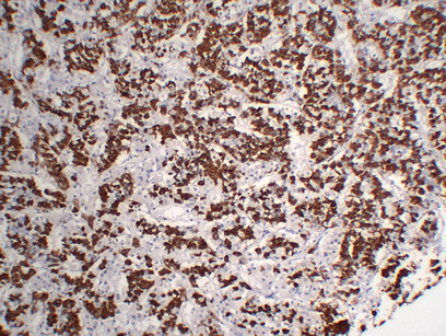 Growth Hormone(GH) (PT1697) mouse mAb