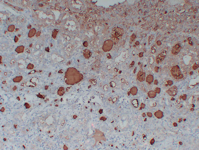Thyroglobulin (PT2174) mouse mAb