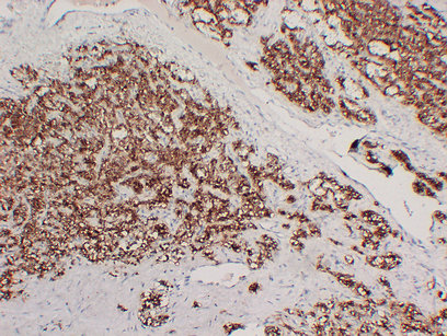 Parathyroid Hormone (PTH) (PT0210) mouse mAb
