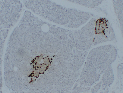 Glucagon (PT1696) mouse mAb