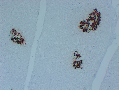 Insulin (PT2015) mouse mAb