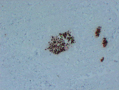 Insulin (PT2015) mouse mAb