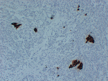 Insulin (PT2015) mouse mAb