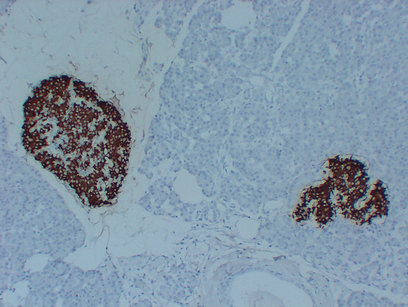 Insulin (PT2015) mouse mAb