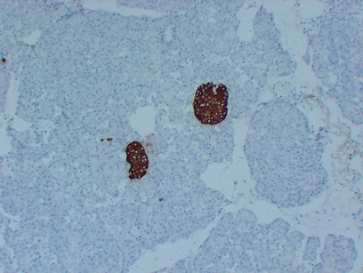 Insulin (PT2015) mouse mAb