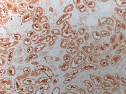 HDAC6 (ABT-HDAC6) mouse mAb