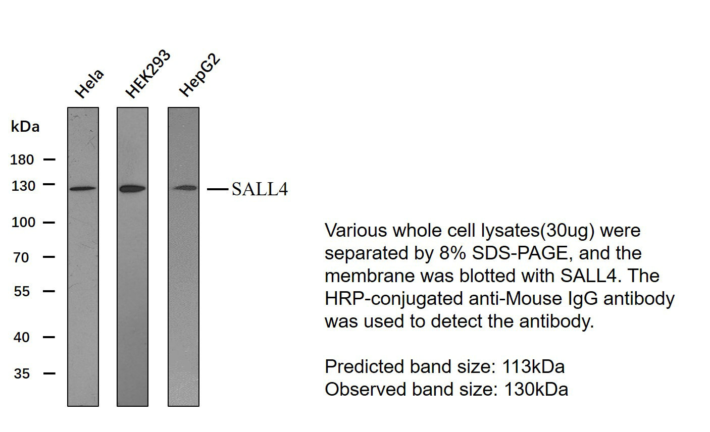 SALL4(PT2242) mouse mAb