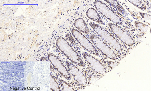 Phospho NFκB/p-NFκB p65 (Ser536) Polyclonal Antibody