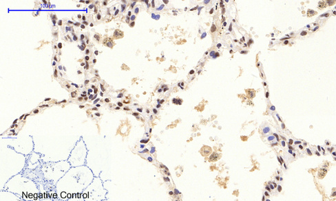 Phospho NFκB/p-NFκB p65 (Ser536) Polyclonal Antibody