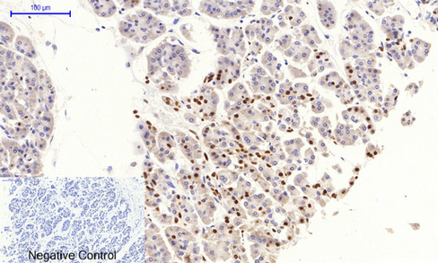 Phospho NFκB/p-NFκB p65 (Ser536) Polyclonal Antibody