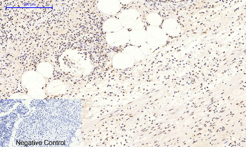 Phospho NFκB/p-NFκB p65 (Ser536) Polyclonal Antibody