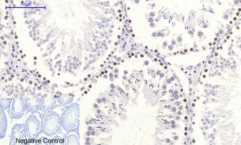 Phospho NFκB/p-NFκB p65 (Ser536) Polyclonal Antibody