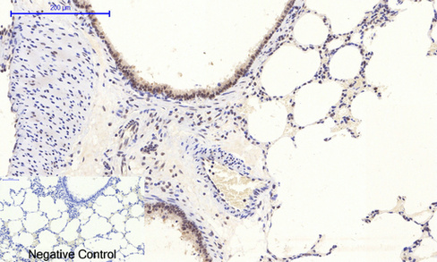 Phospho NFκB/p-NFκB p65 (Ser536) Polyclonal Antibody