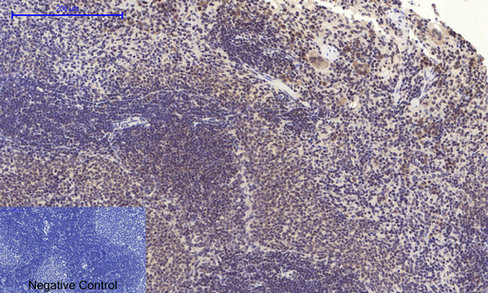 Phospho NFκB/p-NFκB p65 (Ser536) Polyclonal Antibody