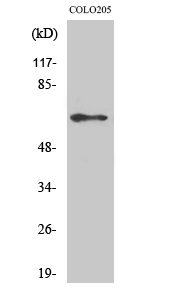 Phospho NFκB/p-NFκB p65 (Ser536) Polyclonal Antibody