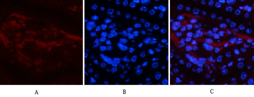 Phospho NFκB/p-NFκB p65 (Ser536) Polyclonal Antibody