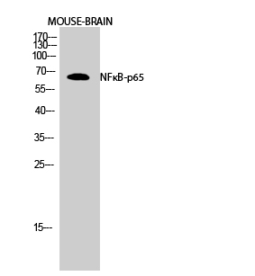 NFκB p65 Polyclonal Antibody