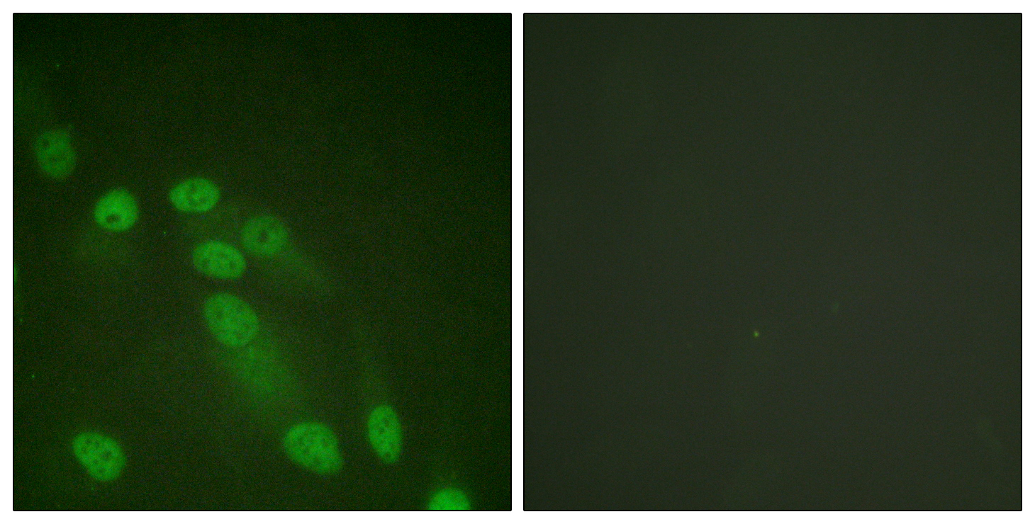 NFκB p65 Polyclonal Antibody