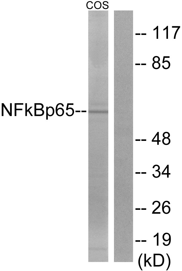 NFκB p65 Polyclonal Antibody