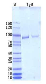 Human Anti-N (SARS-COV-2) IgM antibody (standard for immunoassay)