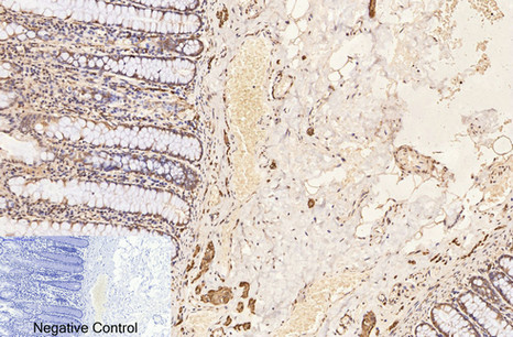 β-Tubulin Monoclonal Antibody(5G3)