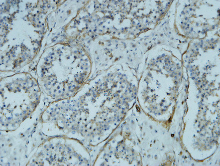 α-SMA Monoclonal Antibody(6A12)