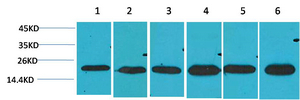 SOD2 Polyclonal Antibody