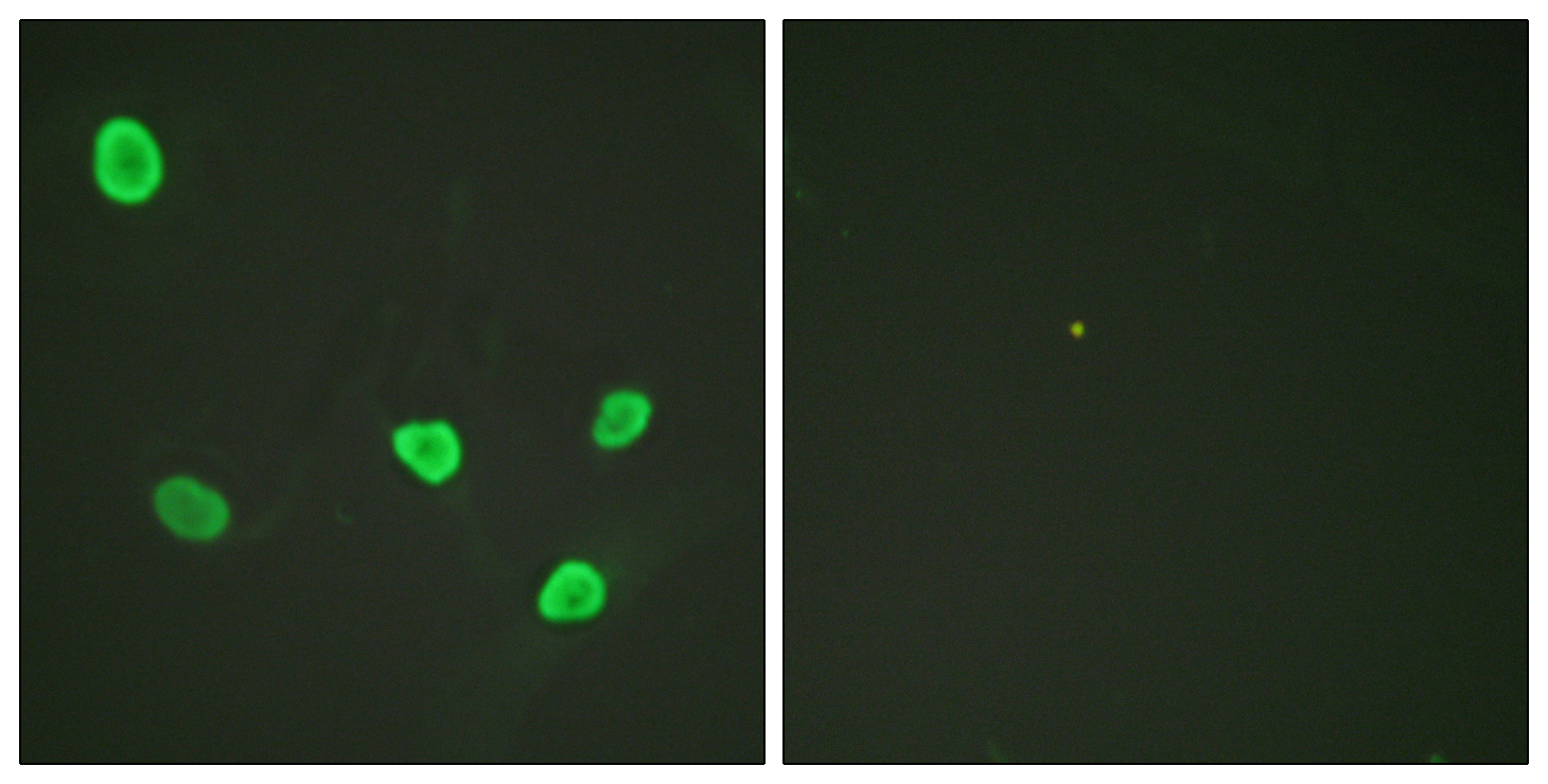 Histone H2B Polyclonal Antibody