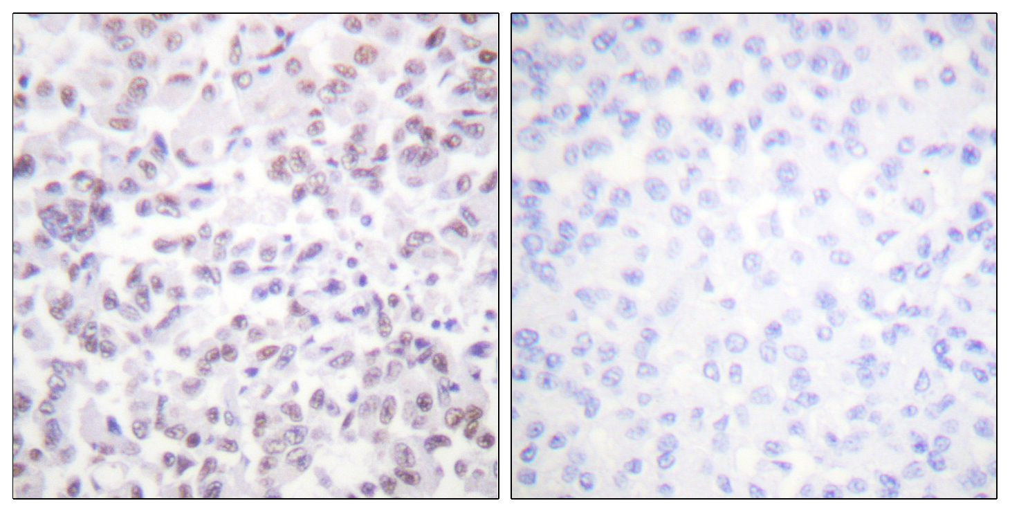 Histone H2B Polyclonal Antibody