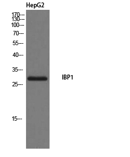 IGFBP1 Polyclonal Antibody