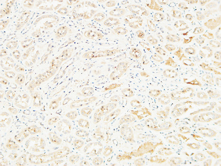 CD26 Polyclonal Antibody