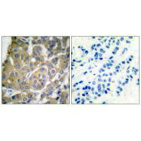 COX2/PTGS2 Polyclonal Antibody