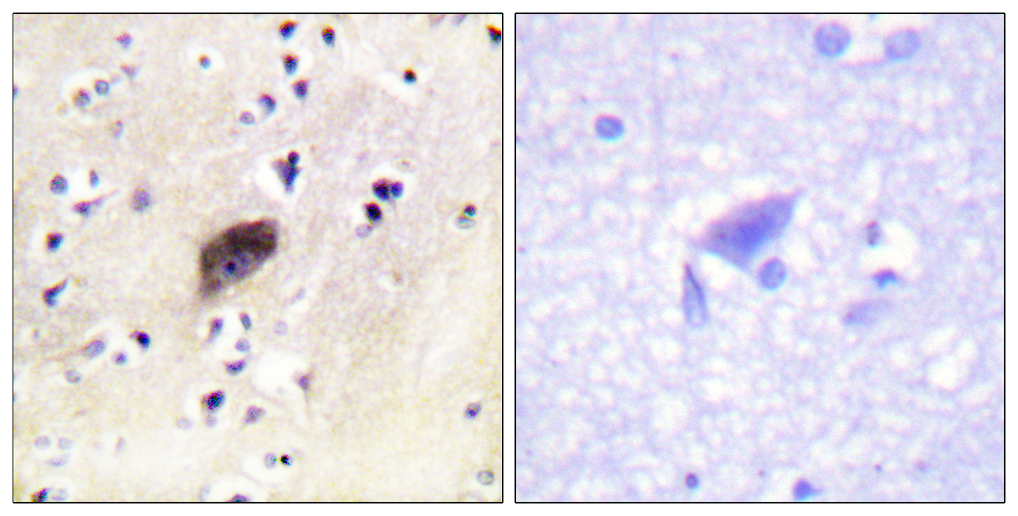 PAKα/β/γ (phospho Ser144/141/139) Polyclonal Antibody