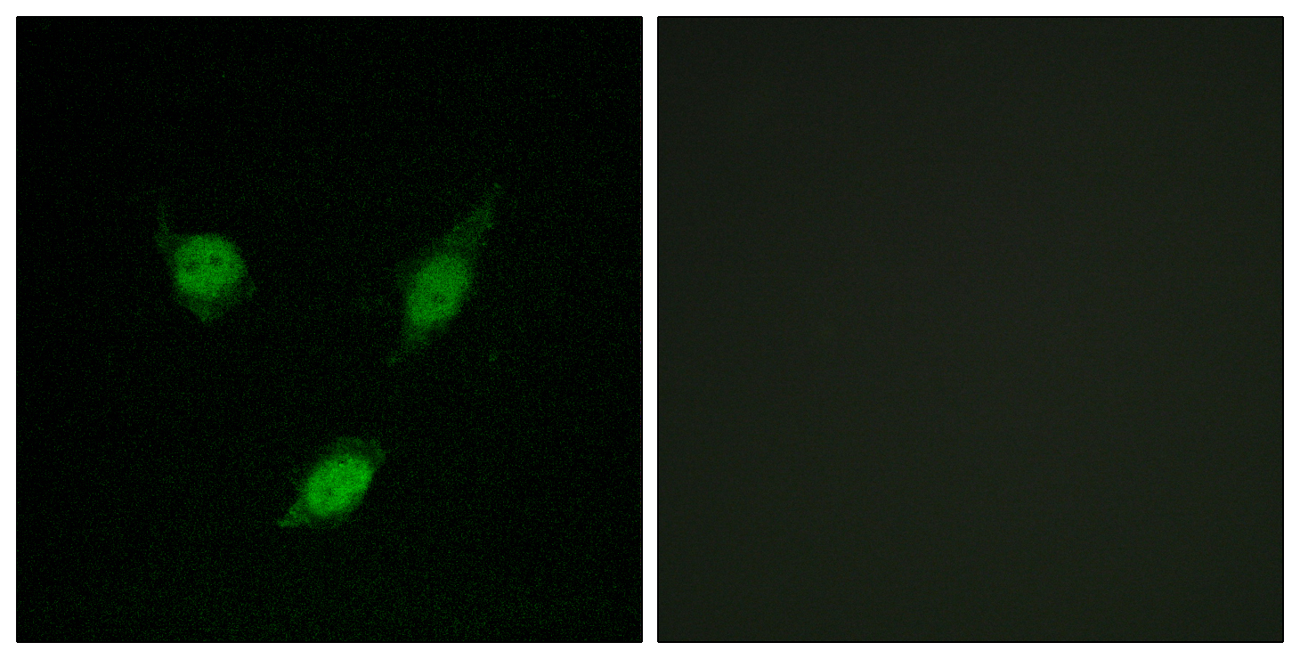 TACC1 Polyclonal Antibody