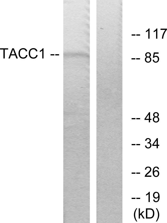 TACC1 Polyclonal Antibody