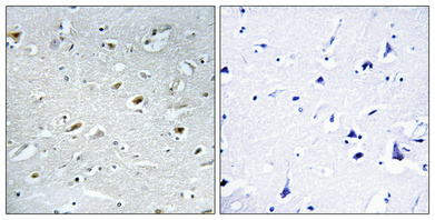 TACC1 Polyclonal Antibody