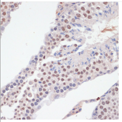 Phospho NFκB/p-NFκB p65 (Ser536) Polyclonal Antibody