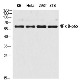 NFκB p65 Polyclonal Antibody